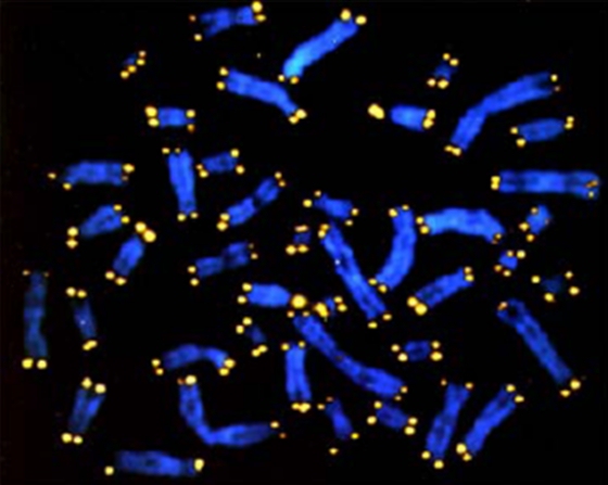 Stress, Aging, and Telomeres - The American Institute of Stress